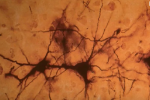 ph020 Deux neuronnes