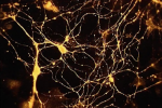 ph022 Neurones marqués à la toxine tétanique